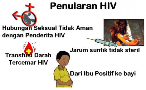 Penularan  HIV  AIDS  PMR SMABHATIG
