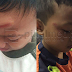 Ustaz Rotan Murid Sampai Lembam, Bengkak Dahi