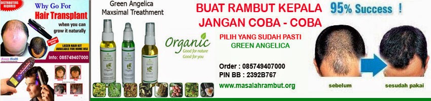 SOLUSI MASALAH RAMBUT BOTAK - RAMBUT RONTOK - RAMBUT UBAN | PENUMBUH