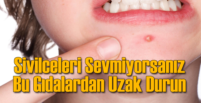 sivilce nasil gecer sivilcelere kesin cozum rehberi tarif dunyasi