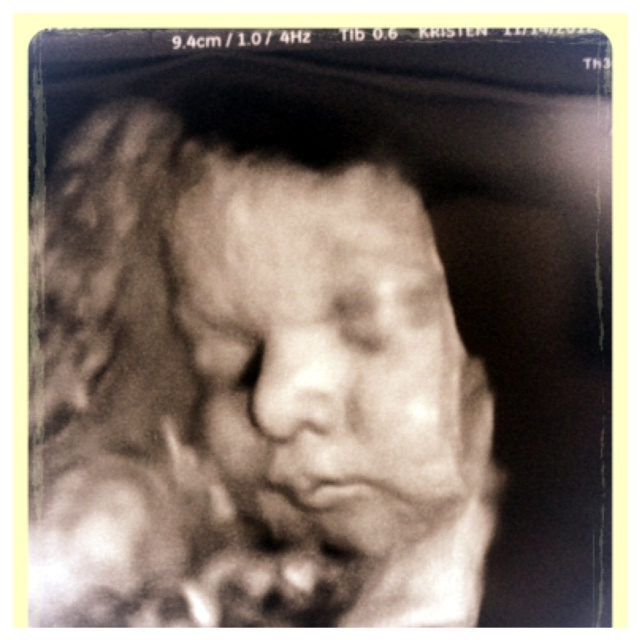 The Moring Times Here s A Picture Of Our Baby At 37 Weeks the-moring-times-here-s-a-picture-of-our-baby-at-37-weeks