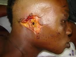 WOMAN BITES OFF POLICEMAN'S EAR IN LAGOS!!! 1