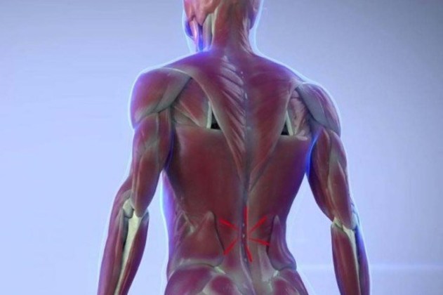 Sciatica Help 4 Friends: A promising alternative for lower back pain