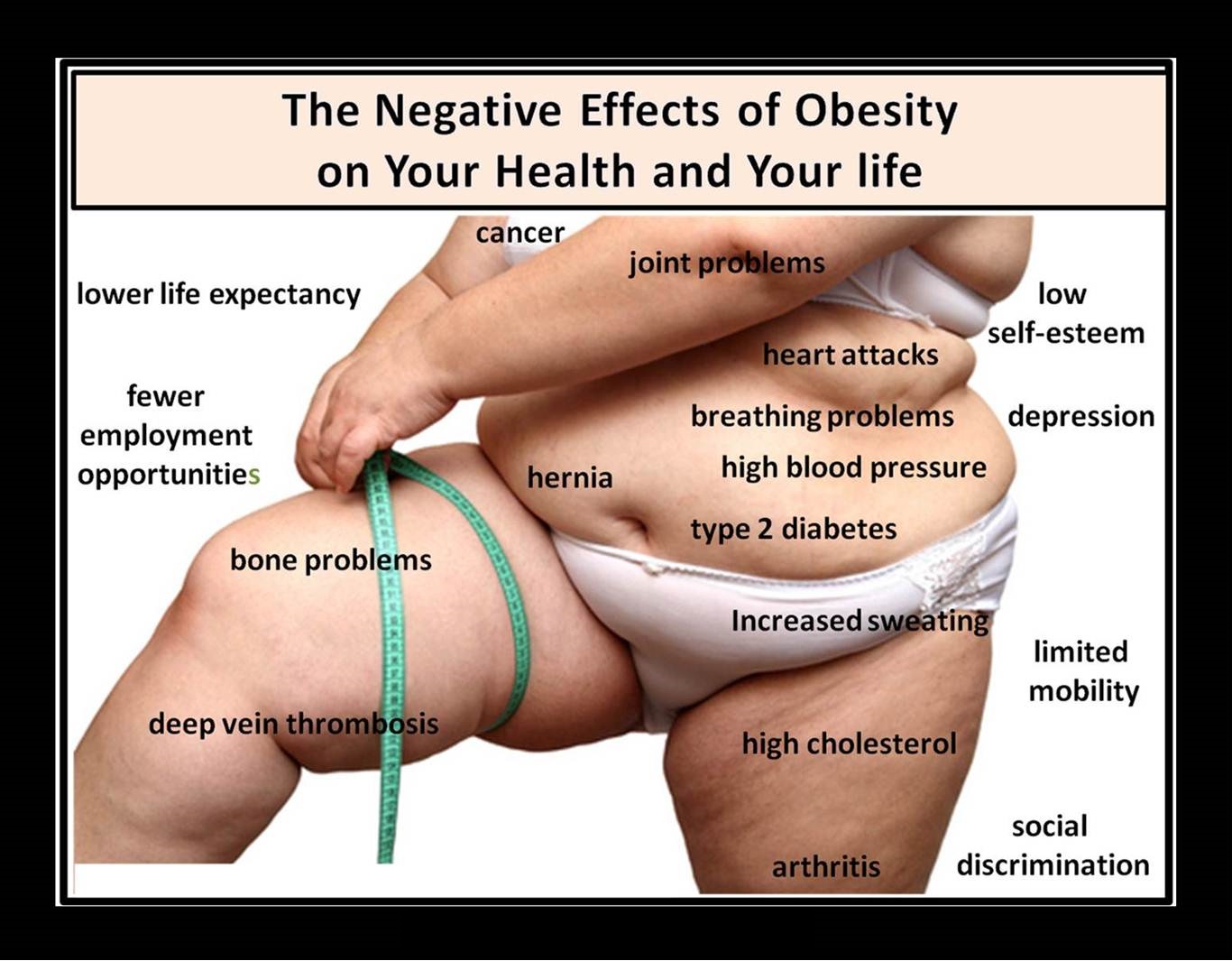 Увеличение веса заболевание. Лишний вес. Последствия лишнего веса.