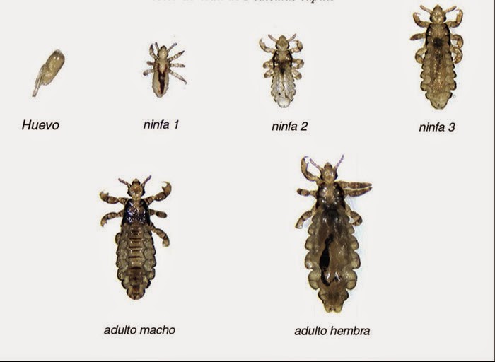 piojos en las pestanas de ninos