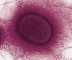 Enterohemorrhagic Escherichia coli (EHEC) Enterohemorrhagic Escherichia coli (EHEC)
