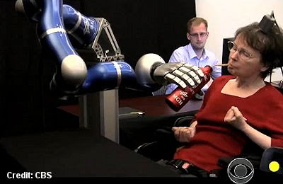 Paralyzed Woman Controls Robotic Arm With Her Thoughts