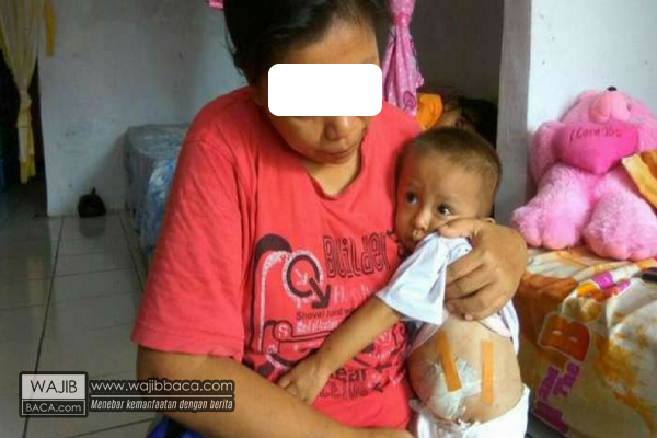 Lahir Dengan Kondisi Cacat, Orangtua Bayi ini Sempat Kepikiran Lahir Dengan Kondisi Cacat, Orangtua Bayi ini Sempat Kepikiran