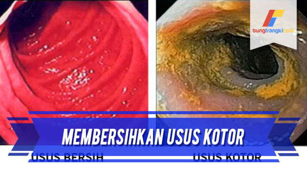 Cara Membersihkan Usus Kotor Hanya Dalam Beberapa Menit