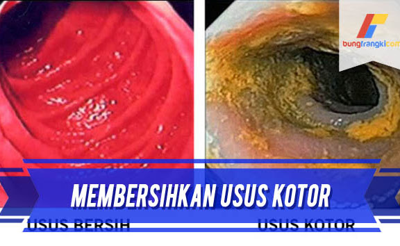 Cara Membersihkan Usus Kotor Hanya Dalam Beberapa Menit