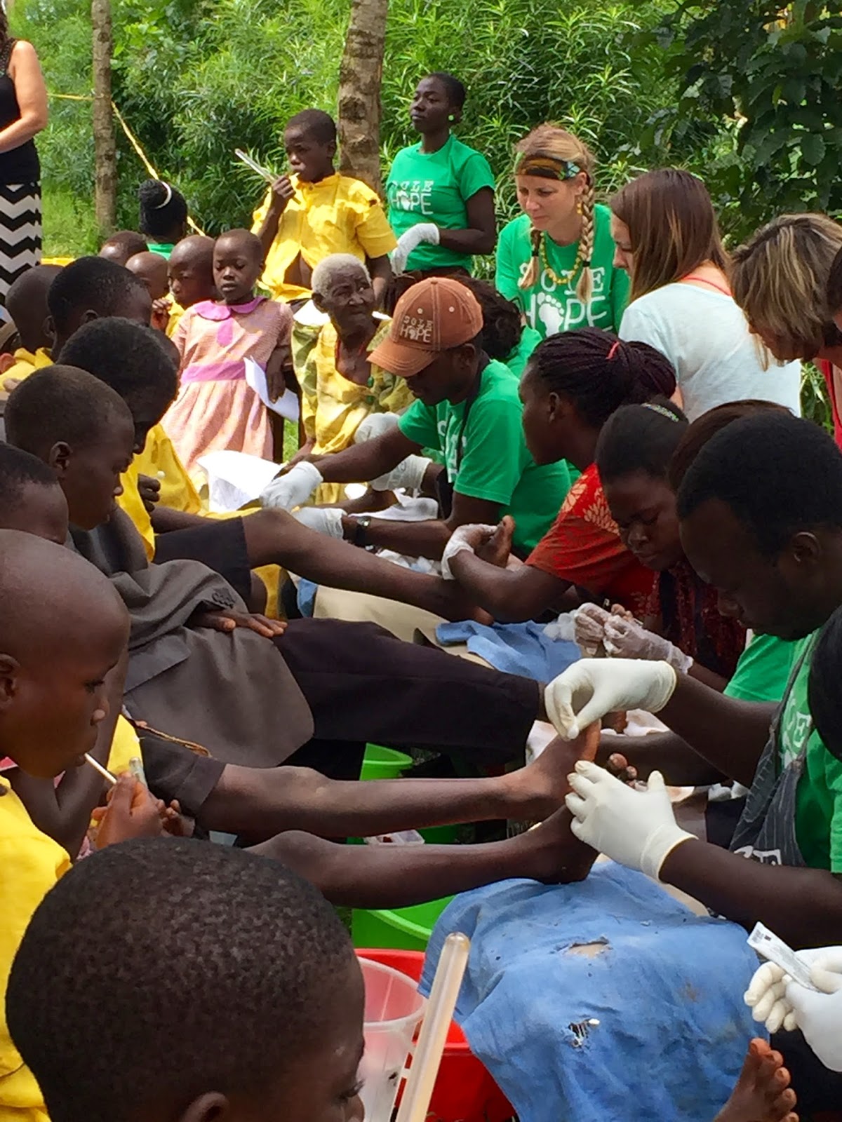 Mommas on a Mission Day 10 Sole Hope Jigger Removal Clinic