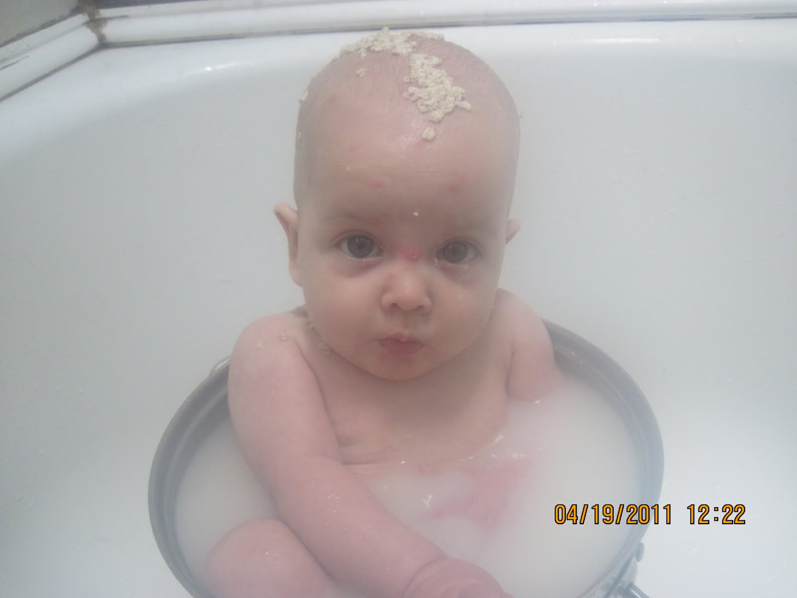 Busy Little Green Family Ella has the Chicken Pox!