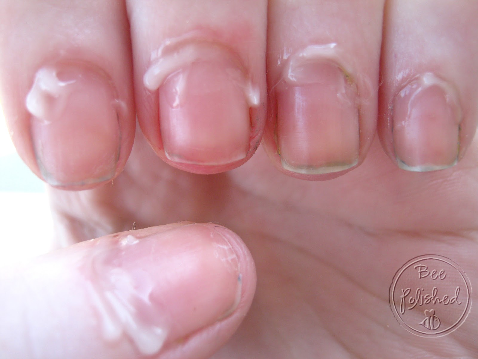 Rehab Your Nails Basic Manicure Bee Polished