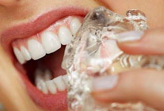 cách chữa đau chân răng cách chữa đau chân răng