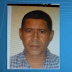 Adolescente de 16 anos é agredida com golpe de machado na cabeça pelo pai