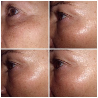 endocare tensage serum