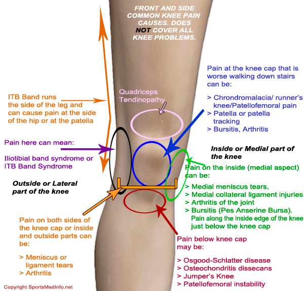 Knee pain location