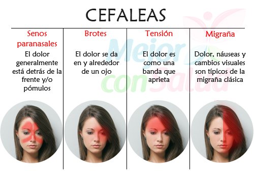 relacion entre lupus y esclerosis multiple