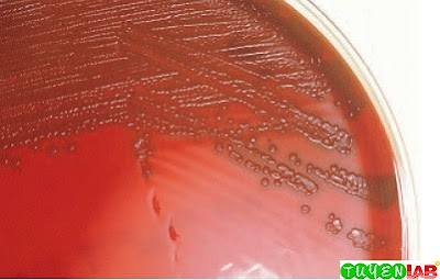 Microbiology Atlas of Streptococcus, Enterococcus, and ...