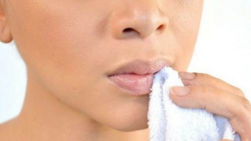Bibir Yang Menghitam Dan Tipsnya Menurut Dr Deby Susanti Vinski Aams Sobat Segar Sehat Bugar