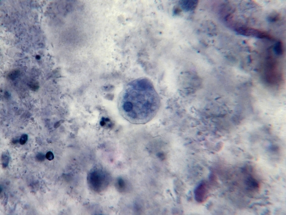 Fun With Microbiology (What's Buggin' You?): Entamoeba histolytica/dispar