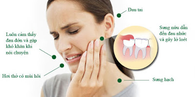 nhổ răng bị ù tai