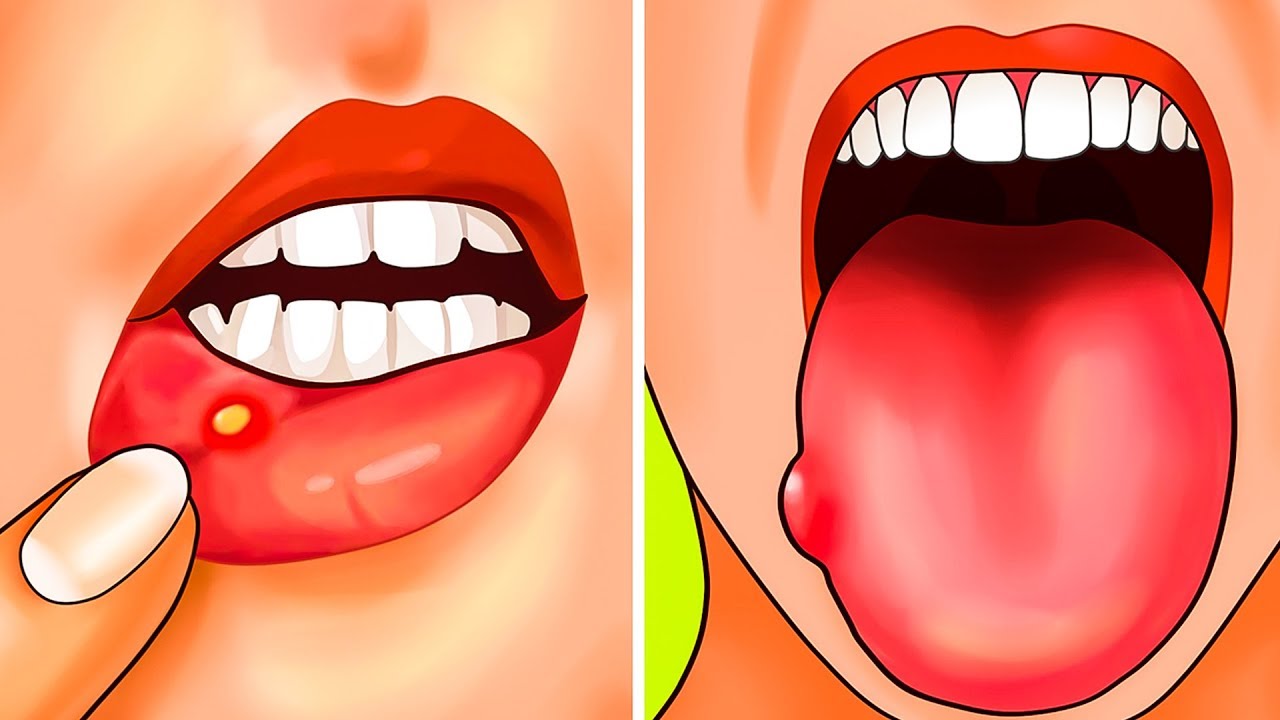 8 علامات تشير إلى حاجة الجسم للمزيد من حمض الفوليك 8 علامات تشير إلى حاجة الجسم للمزيد من حمض الفوليك