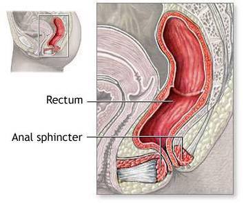 Makattan Cinsel Iliski