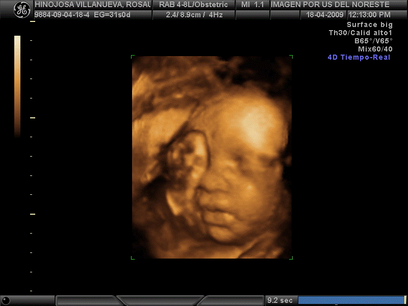 25 Weeks Pregnant Week By Week Obstetrics And Gynecology Ob