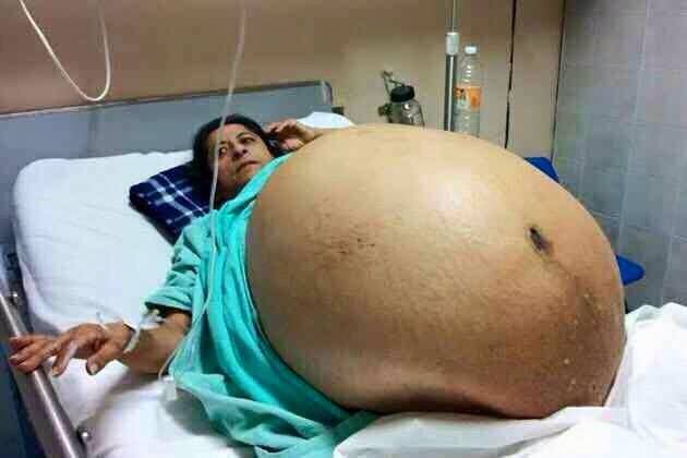 INDIAN WOMEN GAVE BIRTH TO 11 CHILDREN IN SINGLE DELIVERY ...