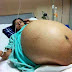 INDIAN WOMEN GAVE BIRTH TO 11 CHILDREN IN SINGLE DELIVERY