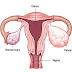 Struma ovarii Definition, Meaning, Symptoms, Causes, Treatment