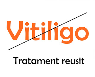vitiligo tratament reusit