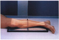 lateral projection legl