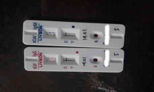 Mengenal Apa Itu Rapid Test Covid19 Dan Cara Kerjanya - omevan.com