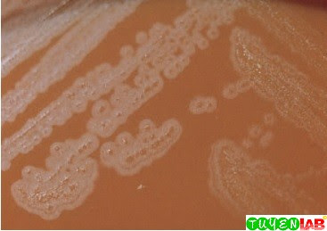 Small, “fuzzy-edged,” umbonate centerappearing colony of Eikenella corrodens on chocolate agar. This organism has the tendency to “pit” the agar. Small, “fuzzy-edged,” umbonate centerappearing colony of Eikenella corrodens on chocolate agar. This organism has the tendency to “pit” the agar.