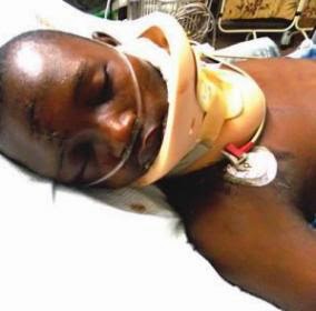 1 Before & After: St Nicholas Hospital shares new photo of accident victim