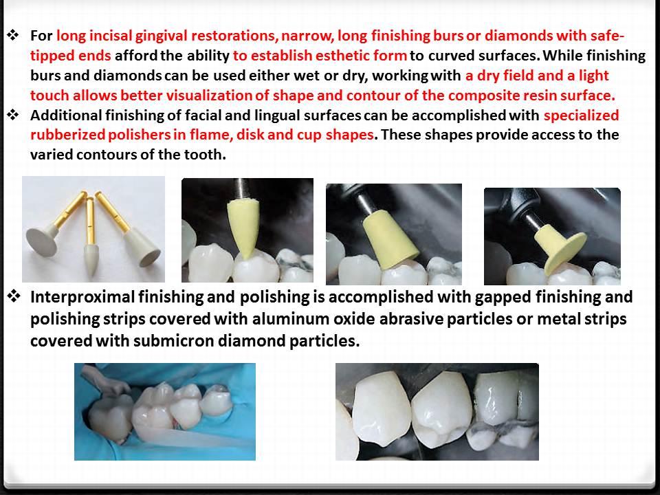 DOs and DONTs in DENTISTRY Polishing Composite Restorations EASY