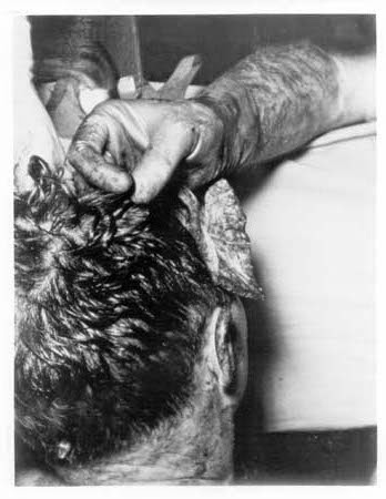 JFK-Autopsy-Photo.jpg