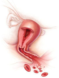 Tahap-tahap Siklus Menstruasi pada wanita