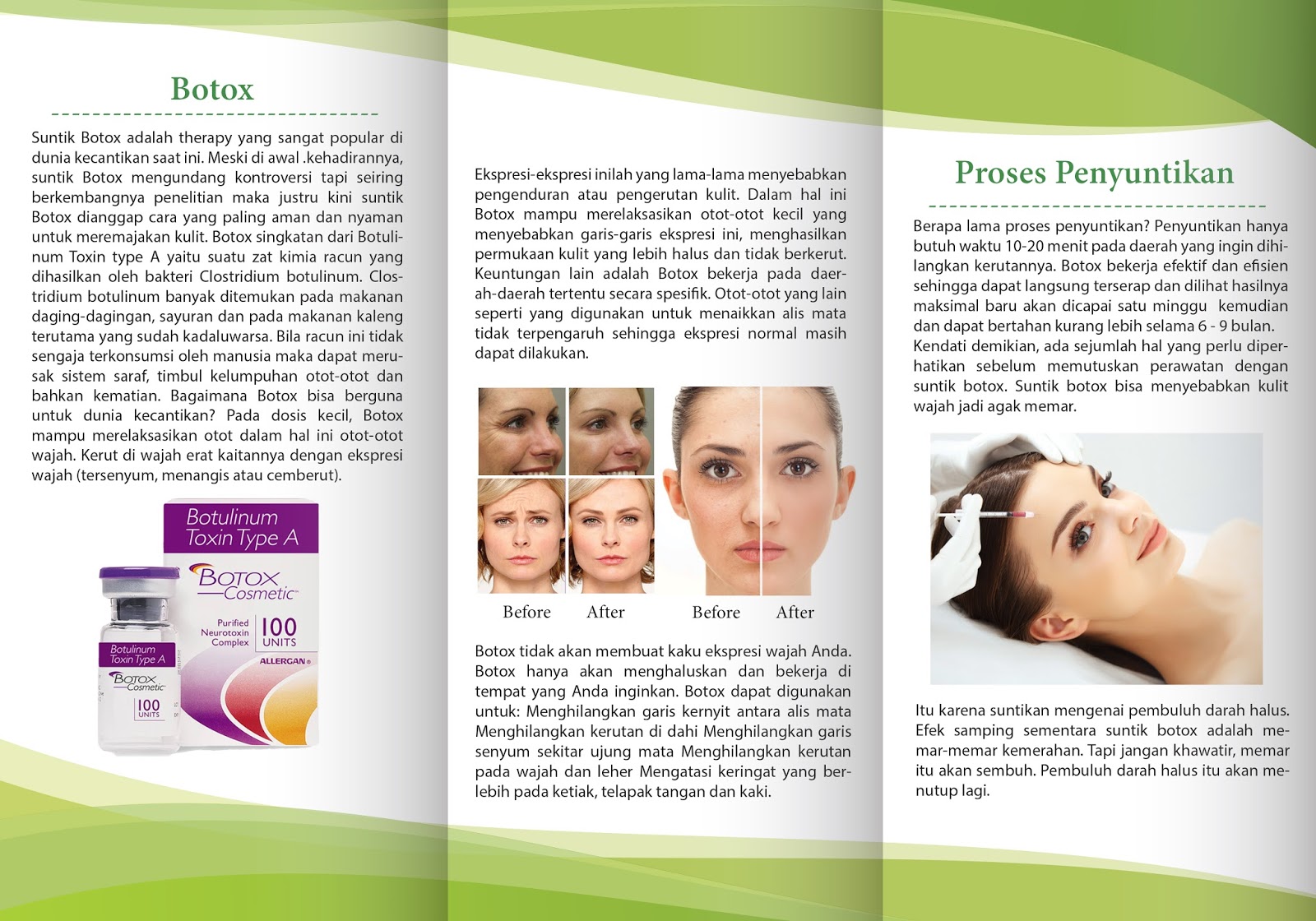 точки введения ботокса в лоб. модели на ботокс для лица. ботулотоксин производители. ботокс презентация. ботокс 100 единиц.