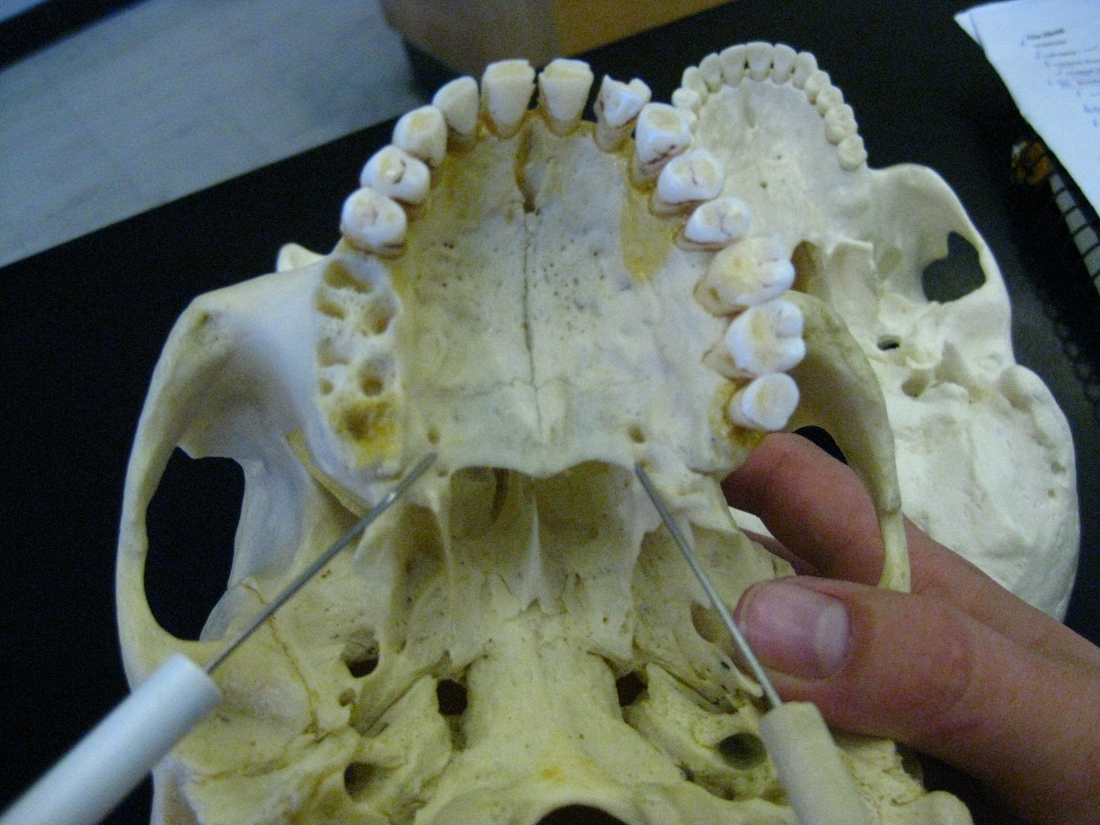 Boned Human Skull palatine foramina (of palatine bone)