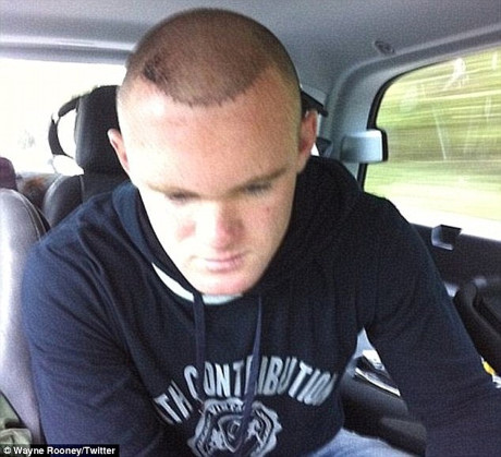 Chi ca ty dong cuu chua, toc cua Rooney van lo tho nhu ong gia - Anh 3