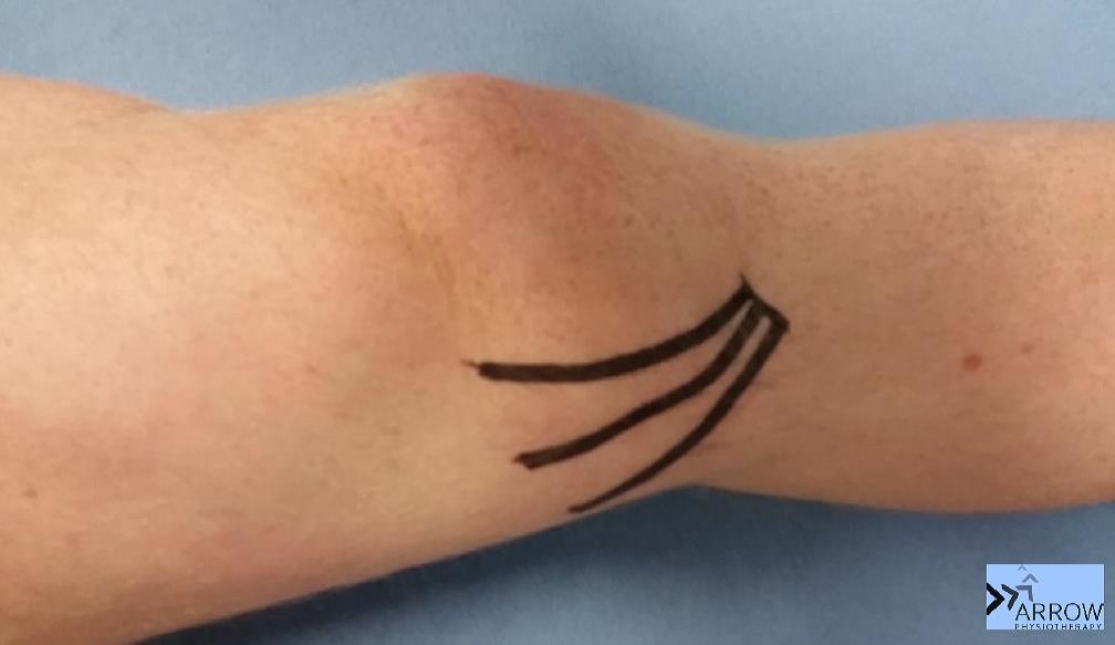 THE SHARP ARROW How's your Goose's Foot?