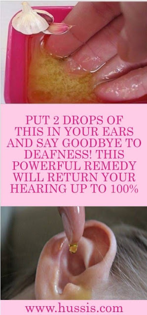 PUT 2 DROPS OF THIS IN YOUR EARS AND SAY GOODBYE TO DEAFNESS! THIS POWERFUL REMEDY WILL RETURN YOUR HEARING UP TO 100%!