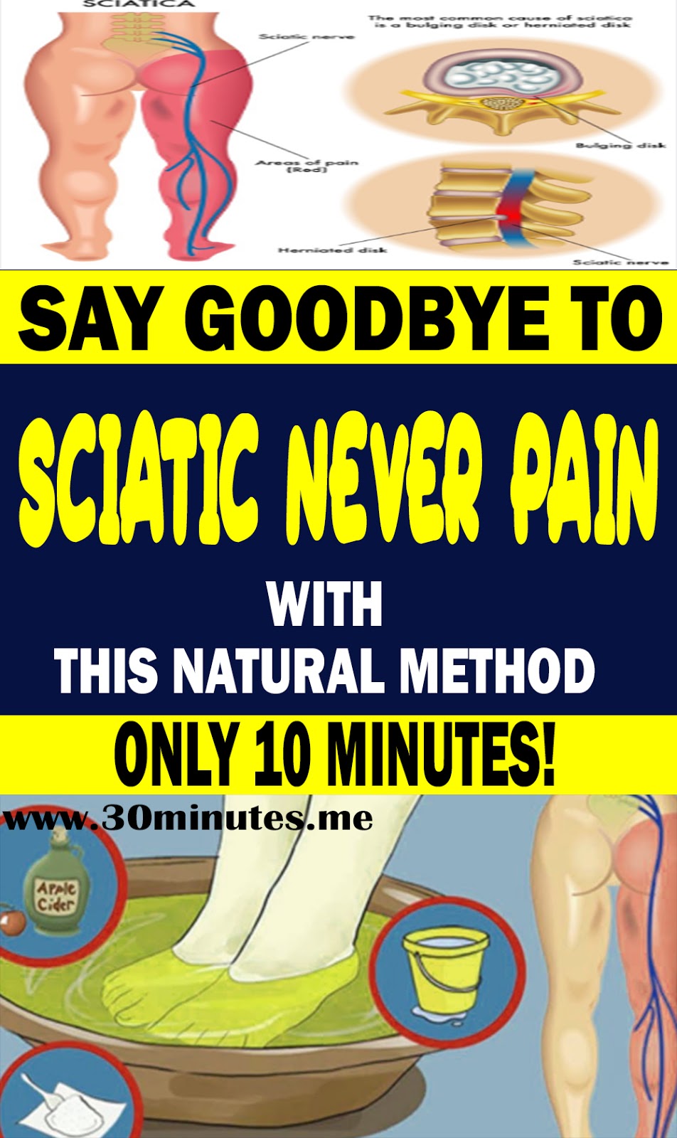 Say Goodbye To Sciatic Nerve Pain In Just 10 Minutes & This Natural