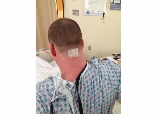 Dave's Big Brain My Chiari Malformation Journey Lucky Man