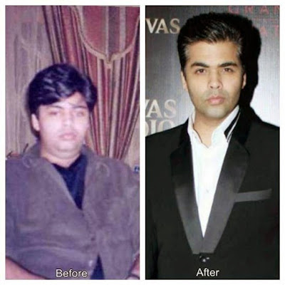Karan Johar before and after weight loss