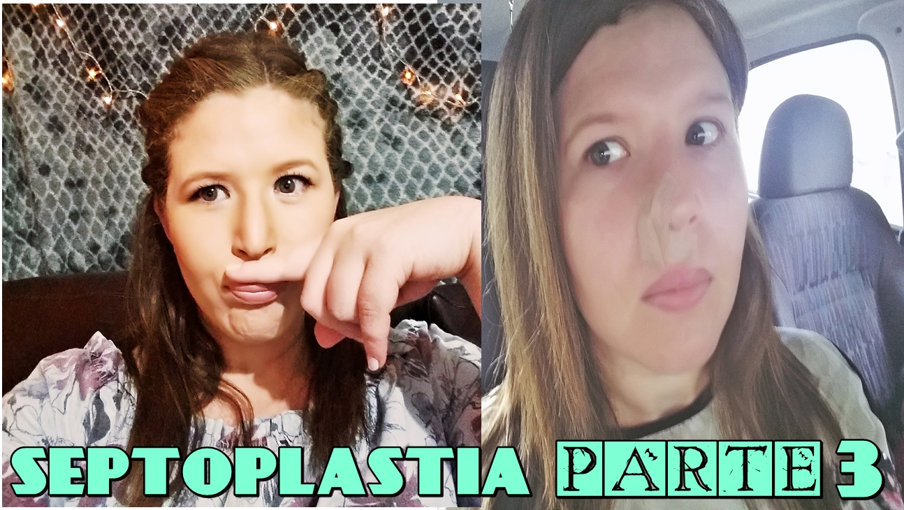 Cirurgia Desvio De Septo Antes E Depois Arrasando e na Moda: MINHA CIRURGIA DE DESVIO DE SEPTO - COM FOTOS