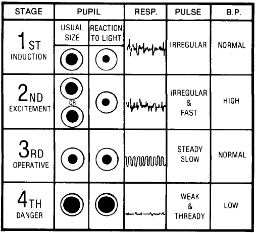 SURGSEMINAR ANESTHESIA STAGES surgseminar-anesthesia-stages